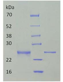 bmp-2-electrophoretogram