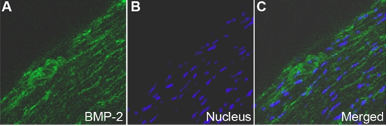 rhbmp-2-figure-3-1