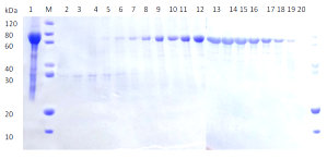 Affinity Chromatography